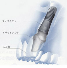 サンプルイメージ