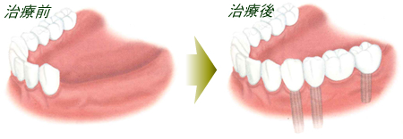サンプルイメージ